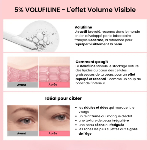 5% Volufiline - effet volume visible du Stick PDRN Collagène Nalizia, avant/après